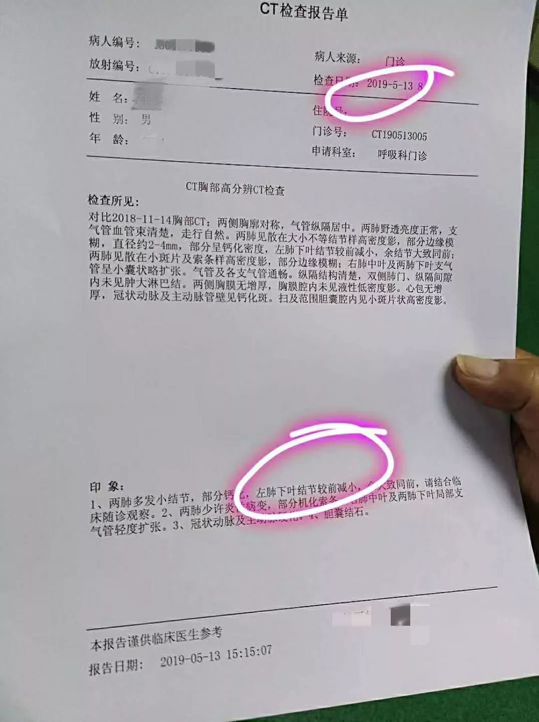 吃药三个月，毛玻璃样结节缩小，可能吗？可能！