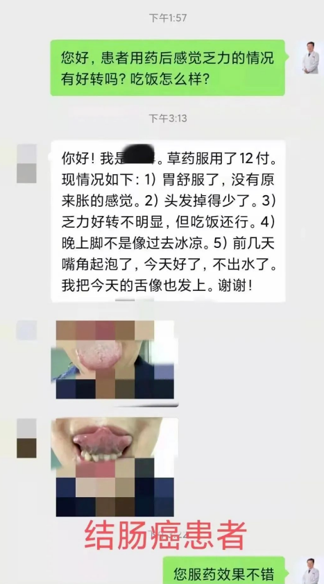 中药治疗癌症效果好吗