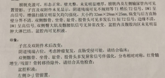 中药治疗肿瘤后明显改善