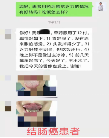 肿瘤治疗好了是否还会复发