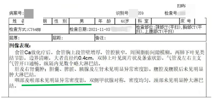 中医治疗恶性肿瘤真的有效果吗 中医治疗食管肿瘤案例