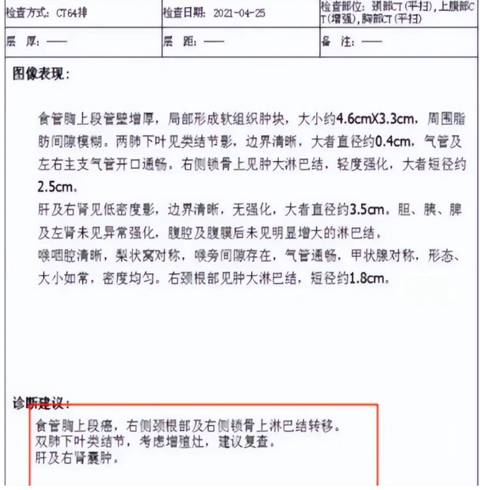 晚期食管癌怎么治疗？中医治疗晚期食管癌有用吗