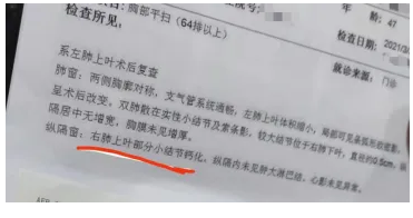 癌症西医治疗的同时可以喝中药吗？肿瘤中西医结合治疗案例