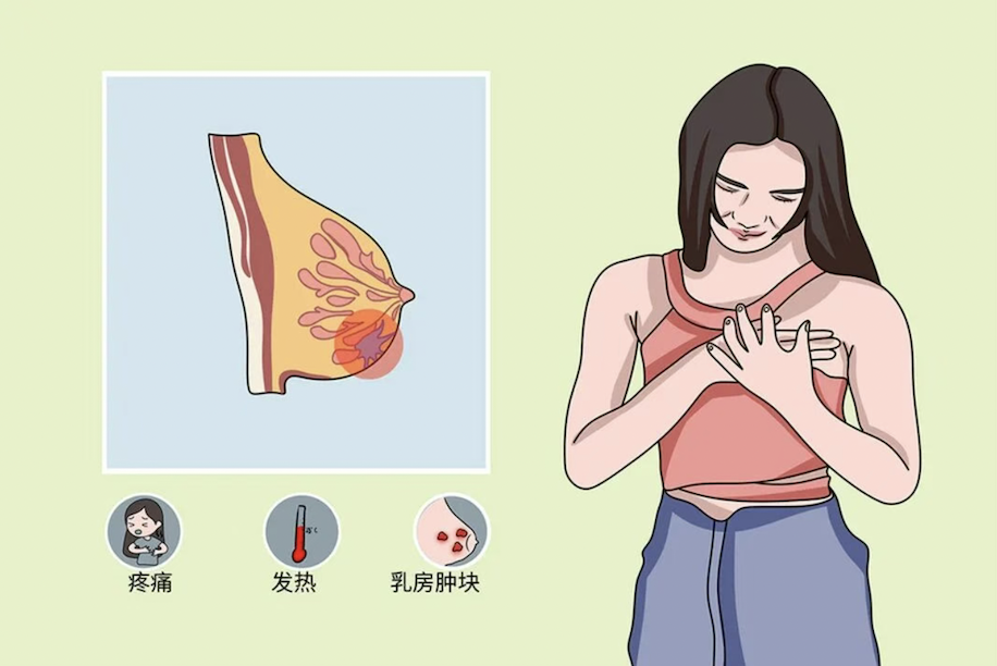 4C结节虚惊一场，3级结节却成癌！两位年轻女性的真实就诊经历，给所有人提了个醒