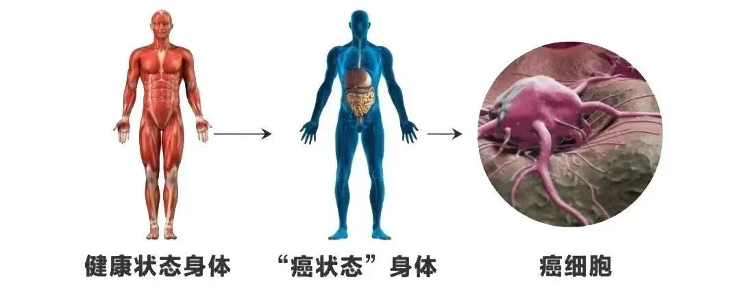 人人都有癌基因，但并非人人都会患上癌症。真正决定癌症是否发生的，是一个容易被忽视却至关重要的概念——“癌状态”。